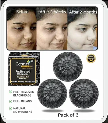 7. Cennet charcoal soap with Activated charcoal for Men & Women skin whitening