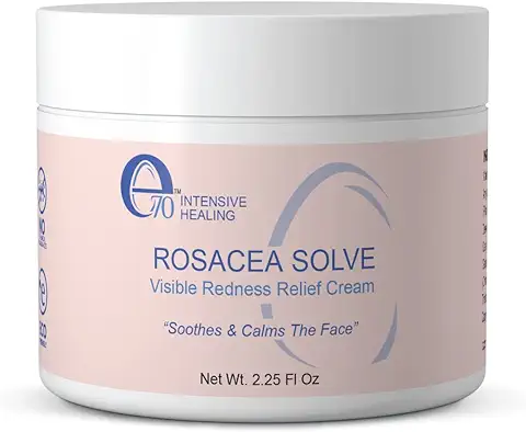 10. Rosacea Solve - Redness Relief Cream - Face Moisturizer For Rosacea & Acne Prone Skin - Sensitive Skin Care With Organic Ingredients, Almond Oil, Licorice & Chamomile Extracts - No Parabens