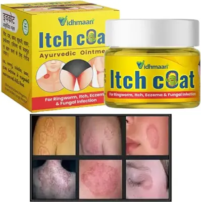9. Vidhmaan Ayurveda Itch Coat fungal Malam Ointment